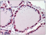 AM09092PU-N - CRABP1