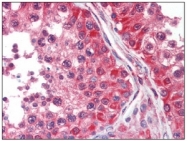 AM11031SU-N - DPYSL2 / CRMP2