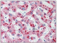 AM20168PU-N - Complement factor H (CFH)