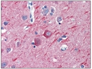 SM568P - alpha Tubulin / TUBA1B