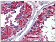 SM568P - alpha Tubulin / TUBA1B