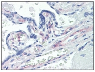 AM20169PU-N - CD140b / PDGFRB