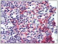 AM20169PU-N - CD140b / PDGFRB