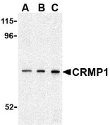 AP30242PU-N - CRMP1 / DPYSL1