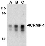 AP30243PU-N - CRMP1 / DPYSL1