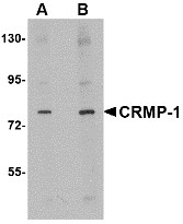 AP30244PU-N - CRMP1 / DPYSL1