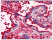 BM745S - Transferrin