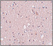 AP30782PU-N - SIPA1L2
