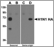AP30771PU-N - Seasonal H1N1 Hemagglutinin
