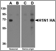 AP30770PU-N - Seasonal H1N1 Hemagglutinin