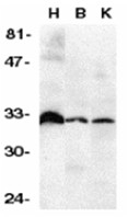 AP30281PU-N - TNFRSF6B / DCR3