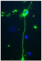 AP20129PU-N - Myelin Basic Protein