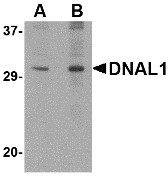 AP30294PU-N - DNAL1