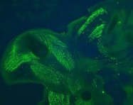 TP401 - GFP