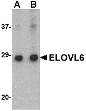 AP30311PU-N - ELOVL6
