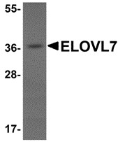 AP30312PU-N - ELOVL7