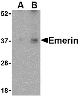 AP30313PU-N - Emerin