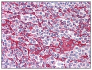 AP07363PU-N - TIMD4