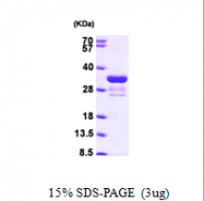 AR09582PU-L - RAD1