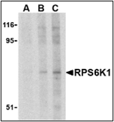 AP30741PU-N - RPS6KA1
