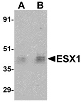 AP30320PU-N - ESX1
