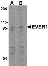 AP30322PU-N - TMC6 / EVER1