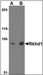 AP30731PU-N - MEX3D / RKHD1