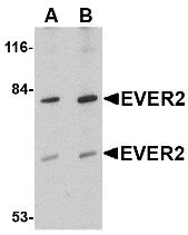 AP30323PU-N - TMC8
