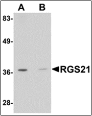 AP30716PU-N - RGS21