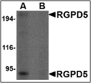 AP30715PU-N - RGPD5 / RGPD6