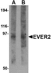 AP30324PU-N - TMC8