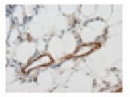 AP20141PU-N - Angiopoietin-1