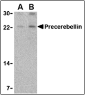 TA306244 - Cerebellin-1