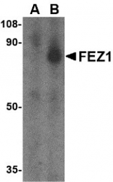 AP30333PU-N - Zygin-1