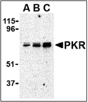 AP30675PU-N - EIF2AK2 / PKR