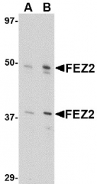 AP30335PU-N - Zygin-2