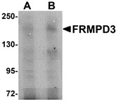 AP30348PU-N - FRMPD3