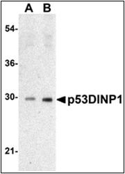 AP30639PU-N - TP53INP1