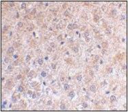 AP30639PU-N - TP53INP1