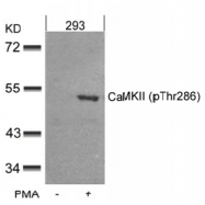 AP02526PU-S - CAMK2A/B