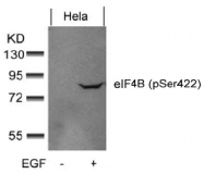 AP09472PU-N - EIF4B