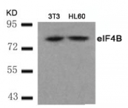 AP09474PU-N - EIF4B