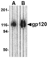 AP30373PU-N - HIV-1