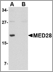 AP30555PU-N - MED28