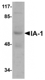 AP30396PU-N - INSM1 / IA1