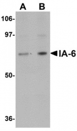 AP30397PU-N - INSM2 / IA6