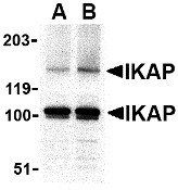 AP30402PU-N - ELP1 / IKBKAP