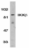 AP30406PU-N - IKBKB / IKKB