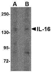 AP30407PU-N - Interleukin-16 / IL16