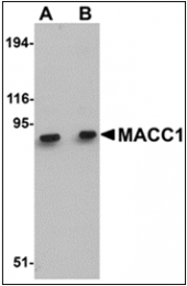 AP30528PU-N - MACC1